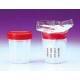 CONTAIN.FR URINE PLP 62.5x73 STER. 150ML 