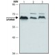 ANTI-SAM68 (N-TERMINAL) IgG fraction of antiserum, buffered aqueous solution,