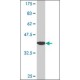 Monoclonal Anti-PTMA antibody produced in mouse, clone 3E5, purified immunoglobulin, buffered aqueous solution,
