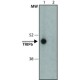 Monoclonal Anti-TRIP6 antibody produced in mouse, ~1.0 mg/mL, clone TRP(N)-12, purified immunoglobulin, buffered aqueous solution,