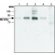 ANTI-DYRK1A (C-TERMINAL) ~1 mg/mL, affinity isolated antibody, buffered aqueous solution,