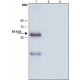 ANTI-MUCOLIPIN-2 (C-TERMINAL) ~1 mg/mL, affinity isolated antibody, buffered aqueous solution,