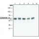 ANTI-CORONIN-1A (C-TERMINAL), ANTIBODY & ~1.5 mg/mL, affinity isolated antibody,