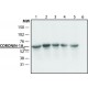 ANTI-CORONIN-1A (N-TERMINAL), ANTIBODY & ~1.5 mg/mL, affinity isolated antibody,