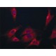 ANTI-CORONIN-1C (C-TERMINAL REGION)& ~1.5 mg/mL, affinity isolated antibody,