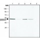 ANTI-DYX1C1 (N-TERMINAL), ANTIBODY PROD& ~1.5 mg/mL, affinity isolated antibody,