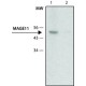 MONOCLONAL ANTI-MAGE-11 , CLONE 4E7& clone 4E7, tissue culture supernatant, isotype IgG2a,