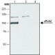 ANTI-PHOSPHOLIPASE A2 (CPLA2)(N-TERM& ~1.5 mg/mL, affinity isolated antibody,
