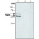 ANTI-PINK1 (N-TERMINAL REGION) ~1.5 mg/mL, affinity isolated antibody, buffered aqueous solution,