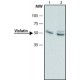 ANTI-VISFATIN (C-TERMINAL) ~1.5 mg/mL, affinity isolated antibody, buffered aqueous solution,