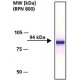 RABBIT ANTI-CATENIN BETA whole antiserum,