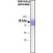 Monoclonal Anti-beta-Catenin antibody produced in mouse,