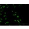 Monoclonal Anti-PARP1, (N-terminal) antibody produced in mouse,