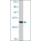 Monoclonal Anti-PTMA antibody produced in mouse,