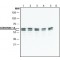 ANTI-CORONIN-1A (C-TERMINAL), ANTIBODY &