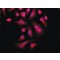 ANTI-PKM2 (C-TERMINAL), ANTIBODY PRODUC&