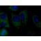 ANTI-AMSH-LP /STAMBPL1, ANTIBODY PRODUC&