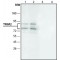 ANTI-TRIM2, ANTIBODY PRODUCED IN RAB&